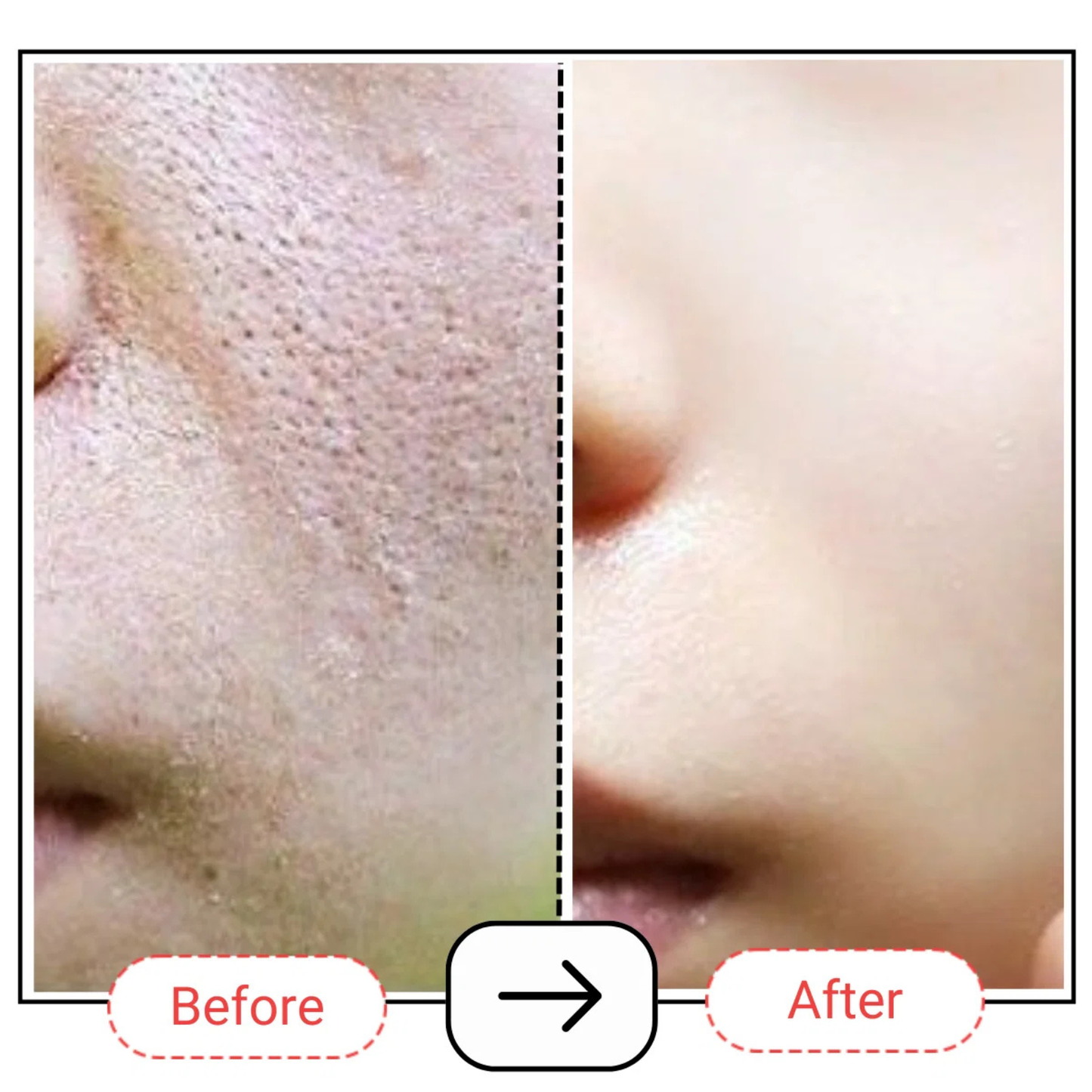 AccuFix Cosmetics AccuPair Skin Barrier Repair Cream with Ceramides