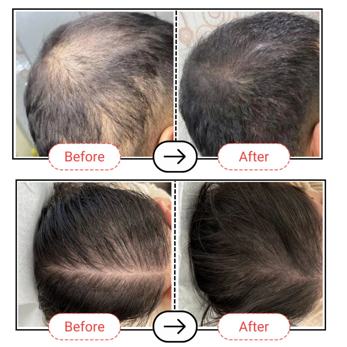 AccuFix Cosmetics Accugrow Advanced Hair Growth Serum