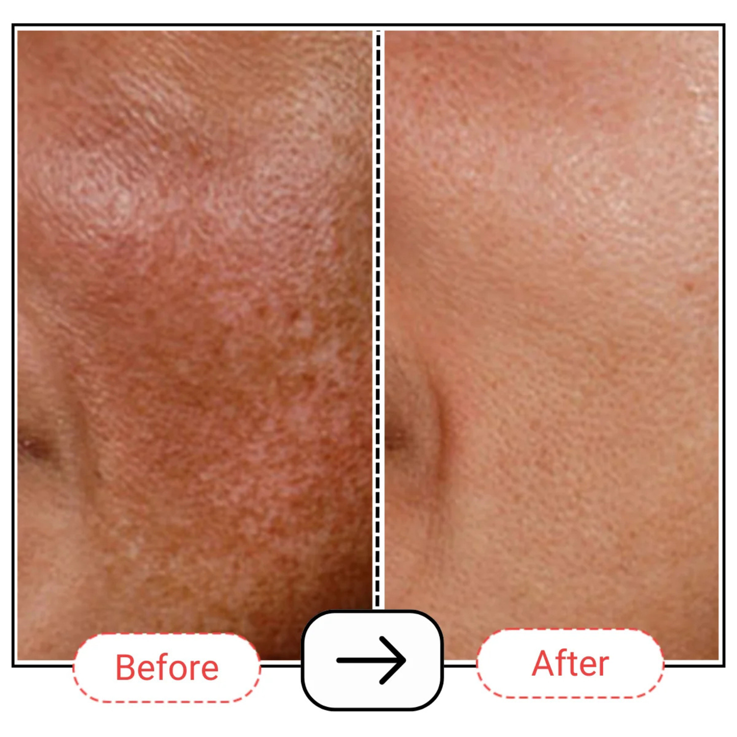 AccuFix Cosmetix Retin-oil Serum 1.0%