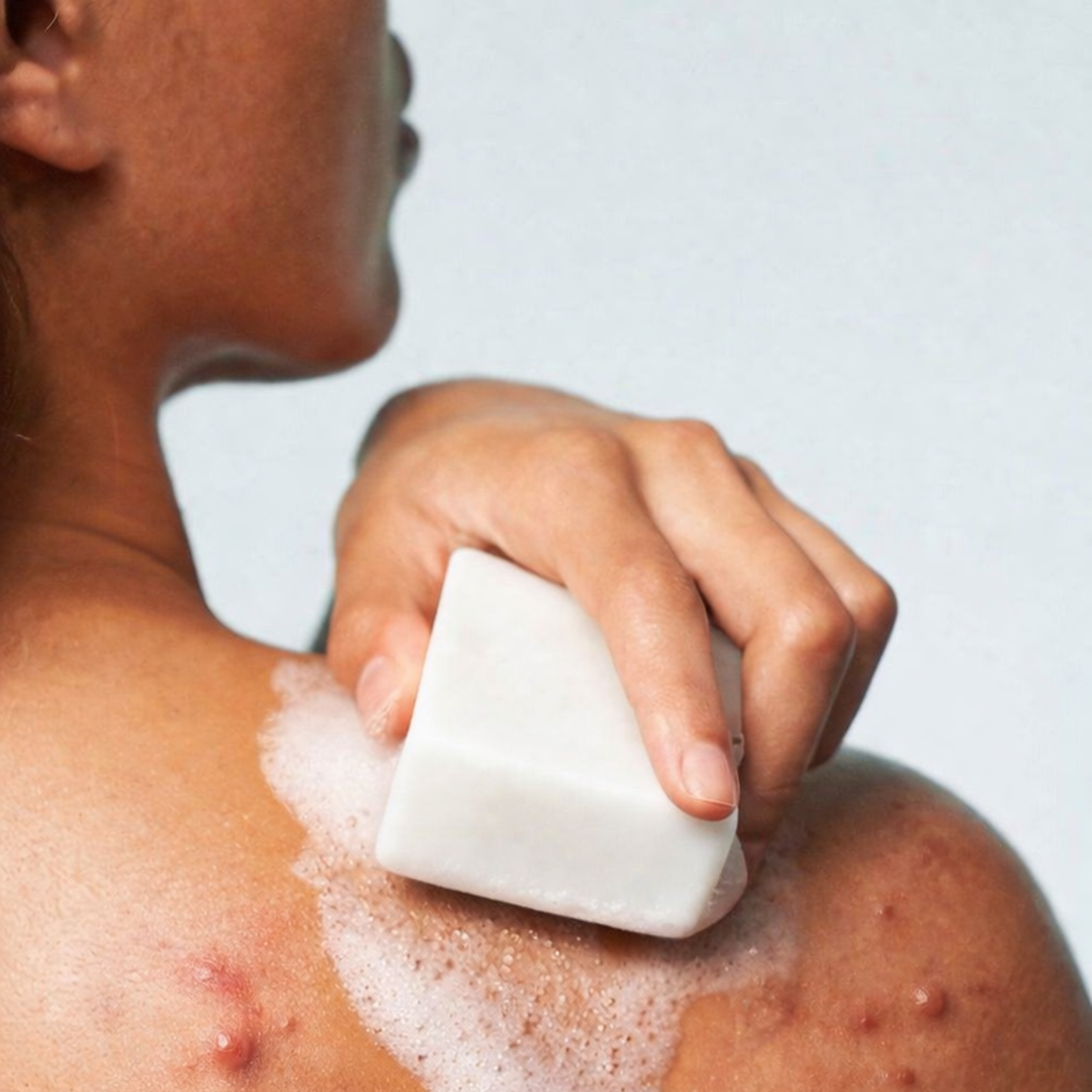 Jenpharm Clarevo Anti-Acne Face & Body Soap