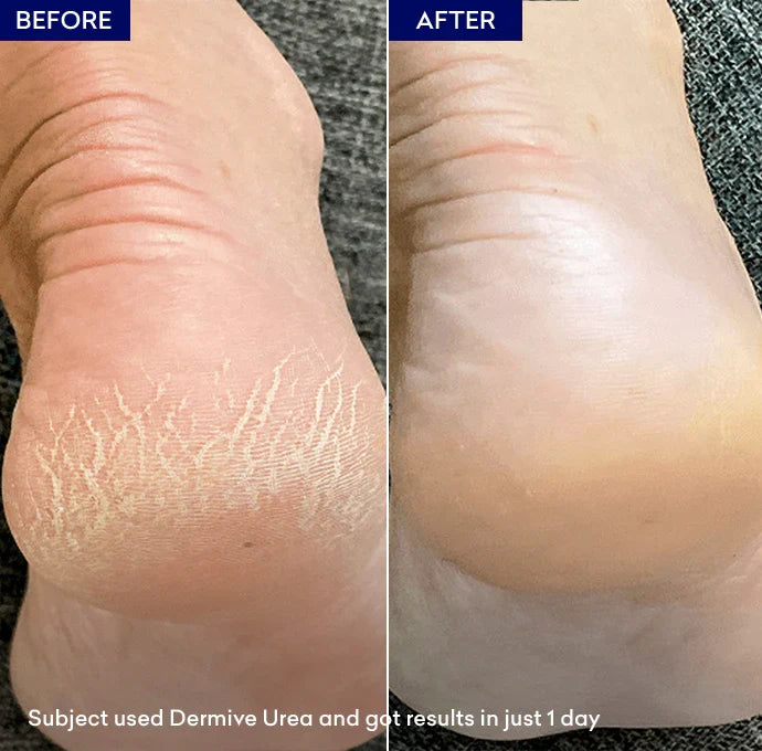 Jenpharm DermiVe Urea Hydrating Healing Lotion
