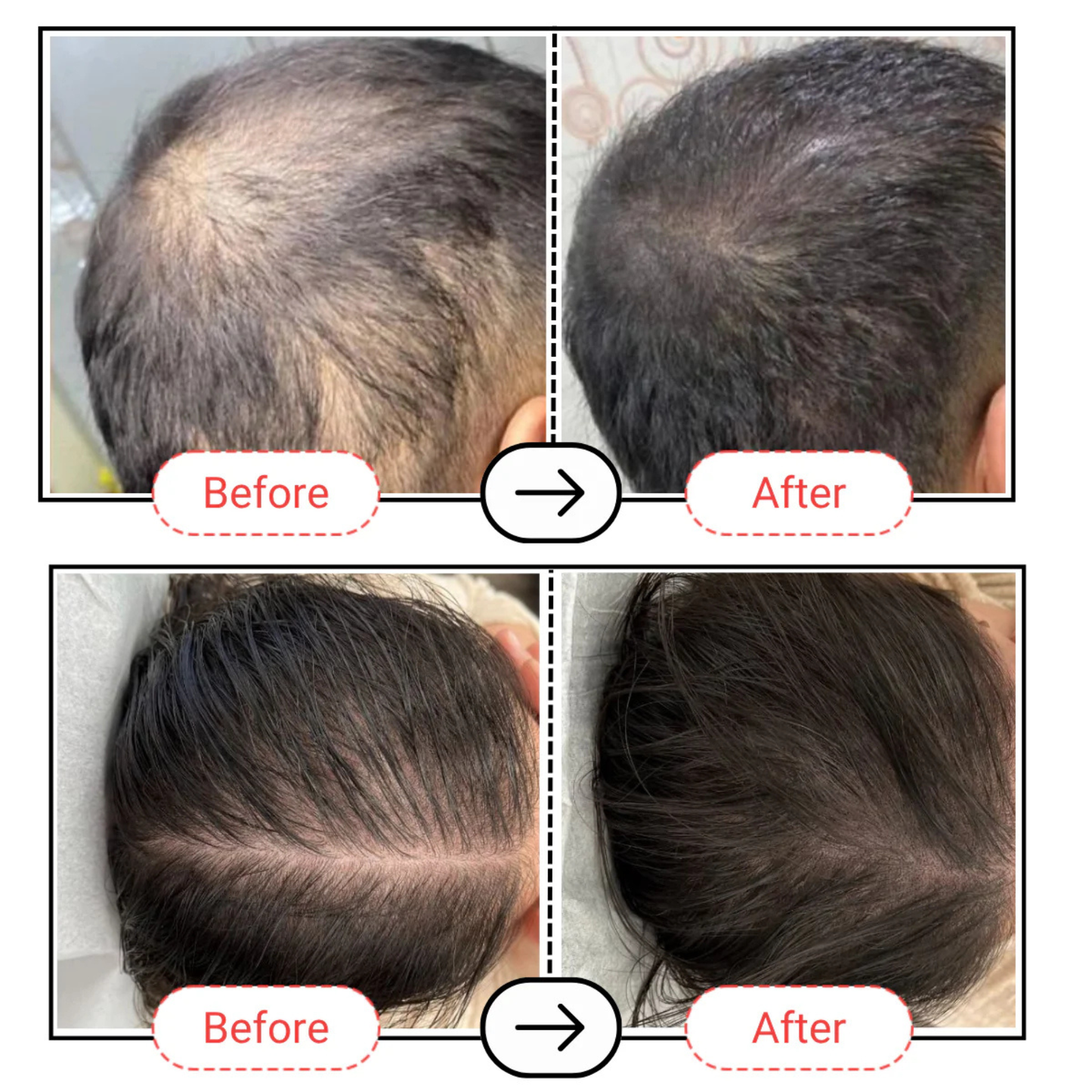 AccuFix Cosmetics Accugrow Advanced Hair Growth Serum
