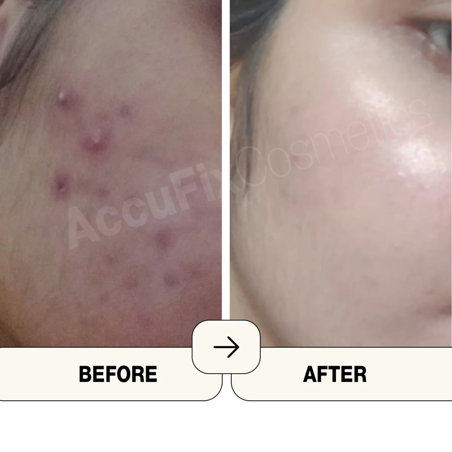 AccuFix Cosmetics Salicylic Acid Cleanser