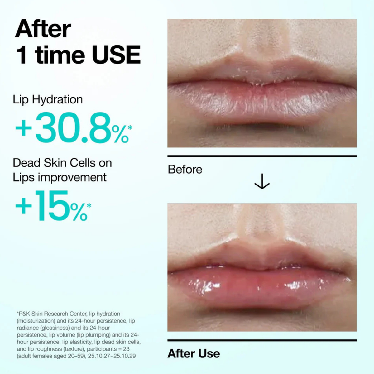 Anua PDRN Hyaluron Lip Serum
