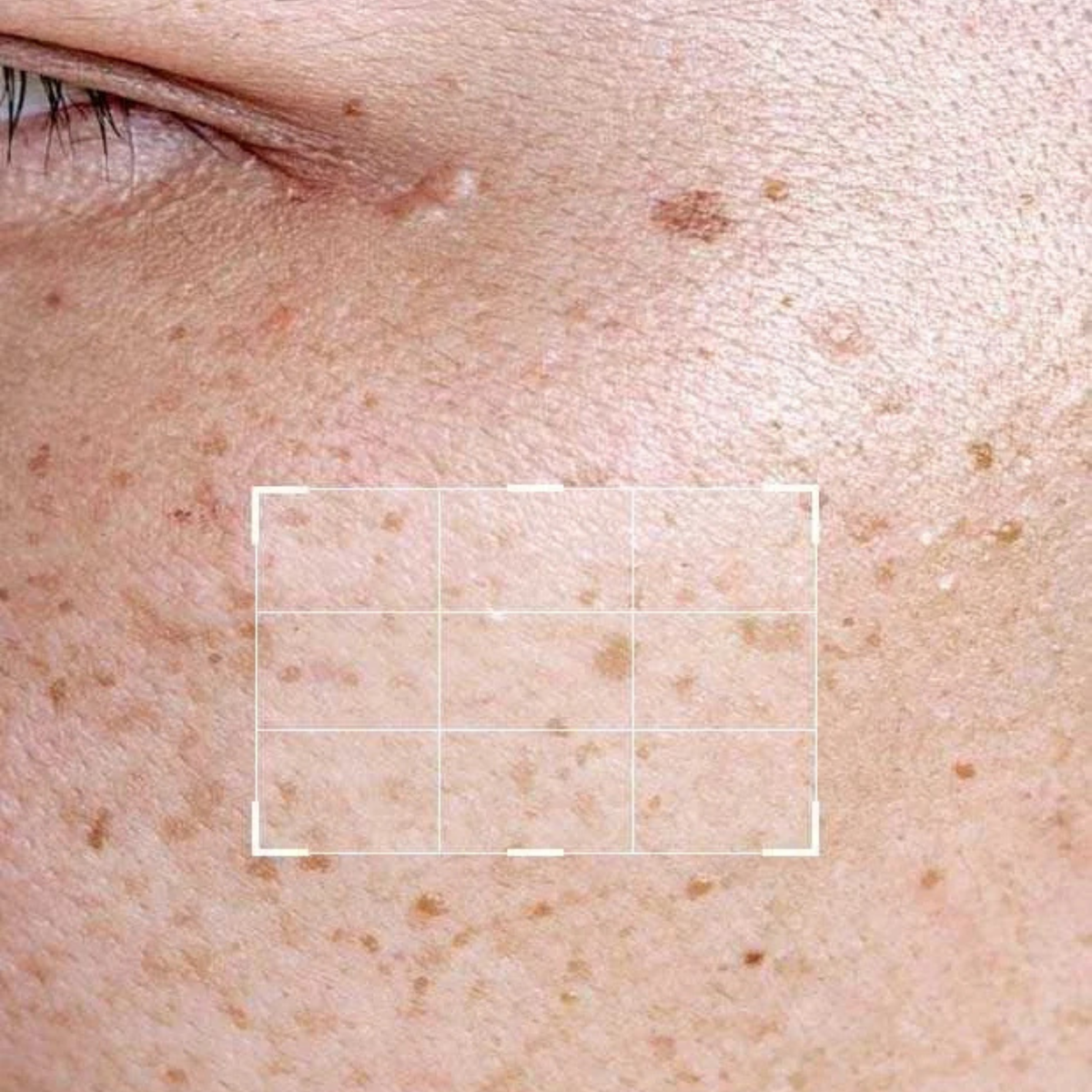 Beautenic Glycolic Acid 7% Serum