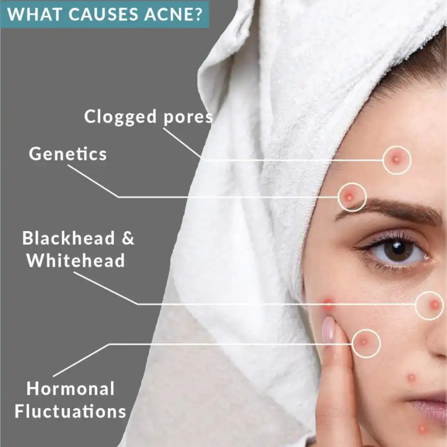 Beautenic Salicylic Acid 2% Clarifying Toner