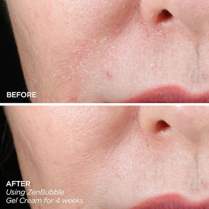 BeautyBio Get That Glow Glopro Facial Microneedling Discovery Set
