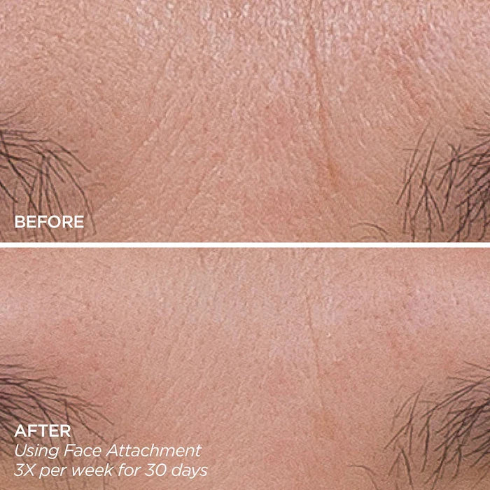 BeautyBio Get That Glow Glopro Facial Microneedling Discovery Set