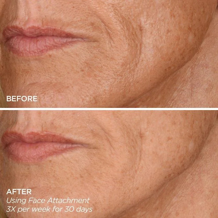 BeautyBio Get That Glow Glopro Facial Microneedling Discovery Set
