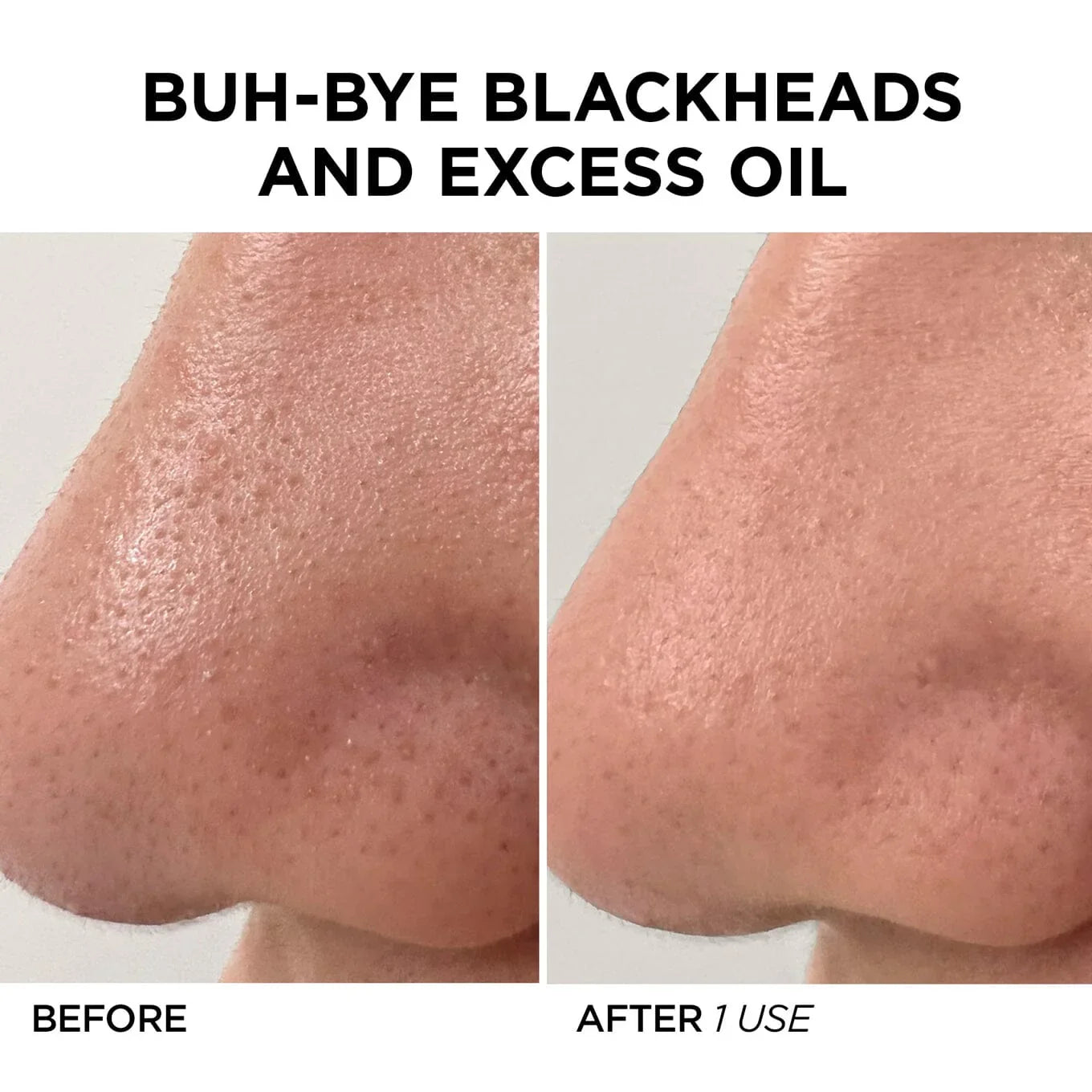 BeautyBio The Glofacial Basic Set