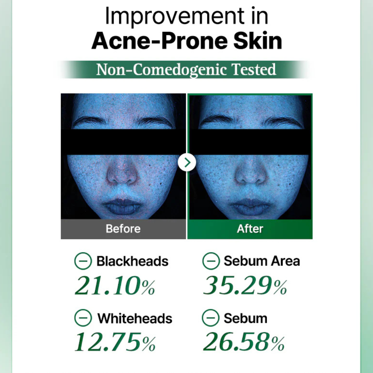 COSRX One Step Original Clear Skin Calming Pad
