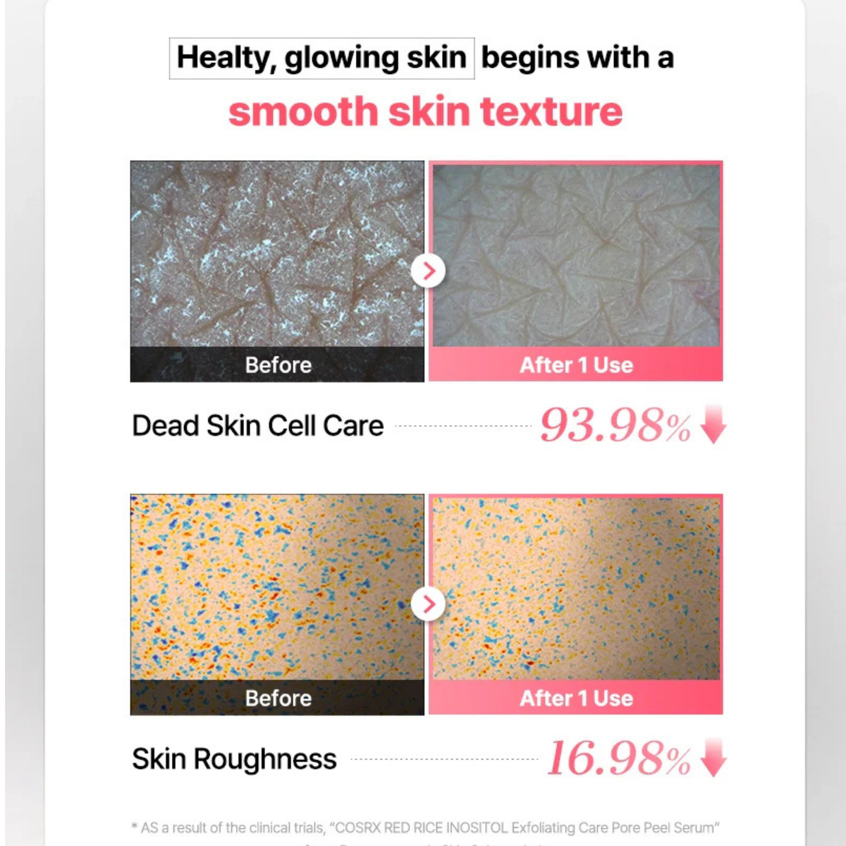 COSRX Red Rice Inositol Exfoliating Care Pore Peel Serum