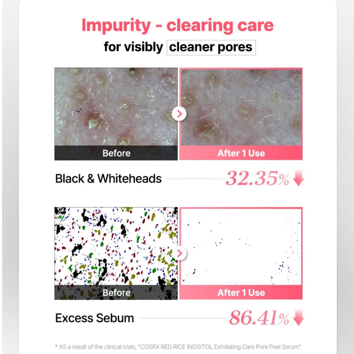 COSRX Red Rice Inositol Exfoliating Care Pore Peel Serum
