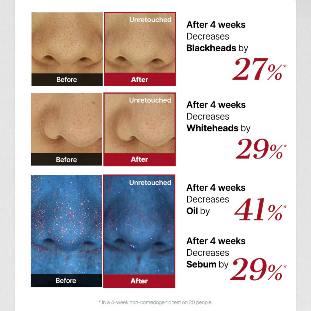 COSRX The AHA 2 BHA 2 Blemish Treatment Serum