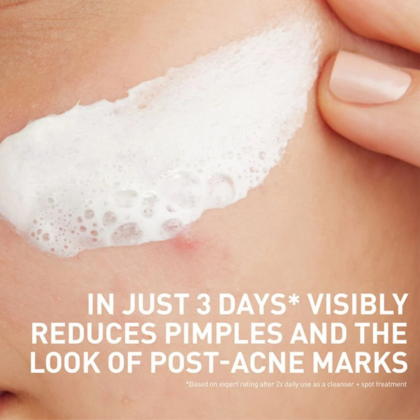 CeraVe Acne Clay To Foam Cleanser