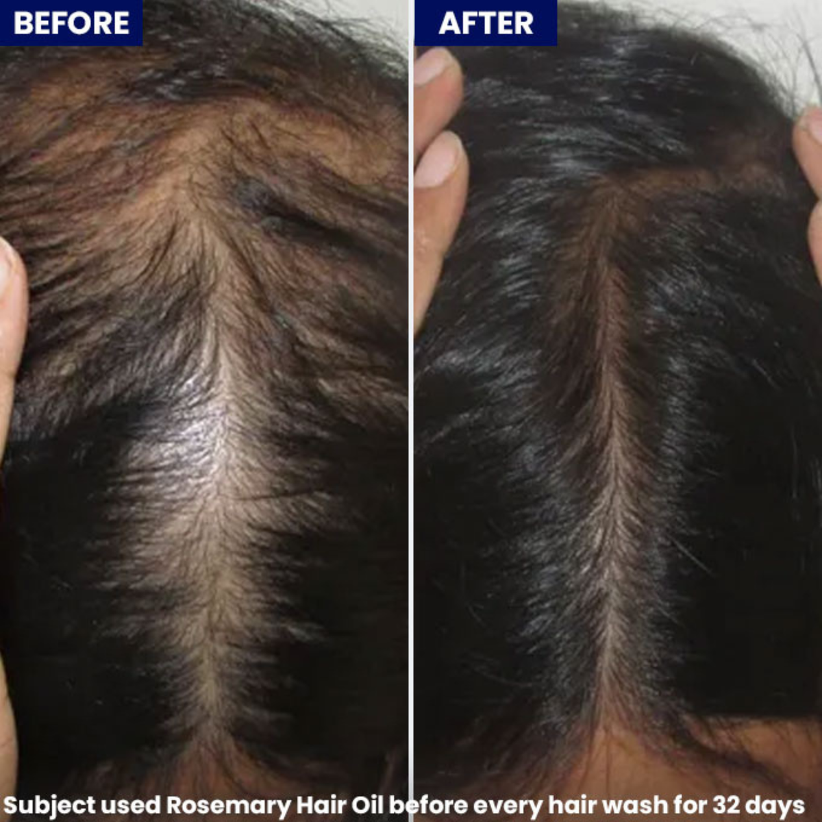 Jenpharm Anagrow Rosemary Hair Growth Oil 100ml