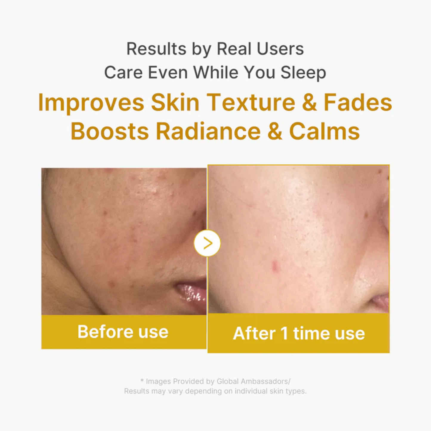 Medicube Kojic Acid Turmeric Night Wrapping Mask 75ml