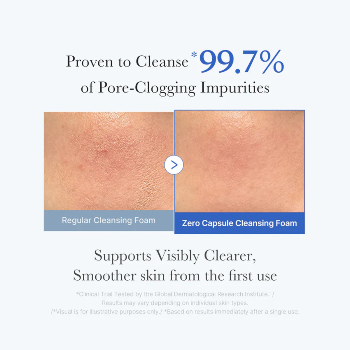 Medicube Zero Pore SA Clear Capsule Cleansing Foam 120gm