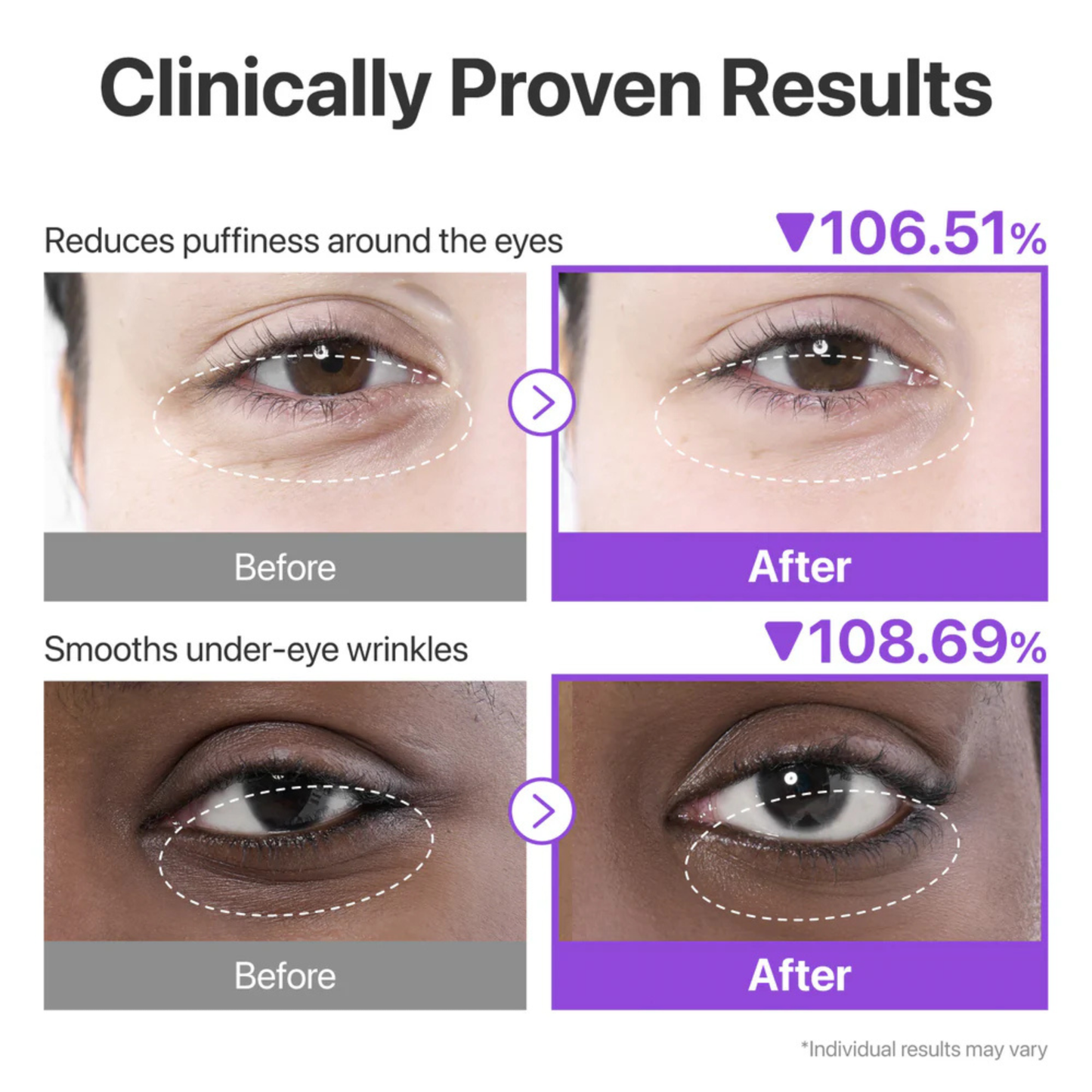 Numbuzin No.9 NMN + Collagen + 50 Peptides Under Eye Patches
