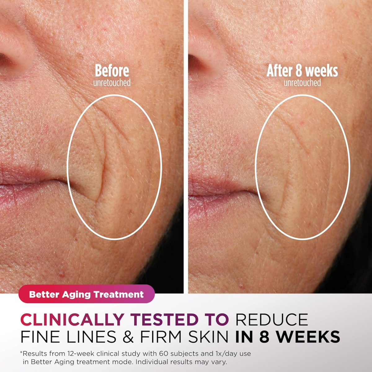 Shark CryoGlow LED Face Mask with Under-Eye Cooling, Anti-Ageing & Repair