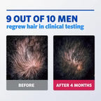 Rogaine Men 5% Minoxidil Topical Aerosol Hair Regrowth Treatment 3 Month Supply Set